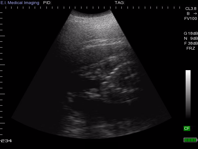 bibi the hippo ultrasound